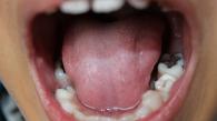 科大破解人類口腔微生物小分子促進牙菌膜形成的奧秘