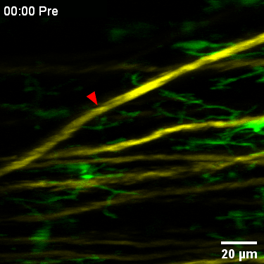 An axon (colored in yellow) is cut off by an ultrafast pulse laser (marked by red arrow) and it shows that the immune cells (colored in green) react quickly and come up to the injury site.
