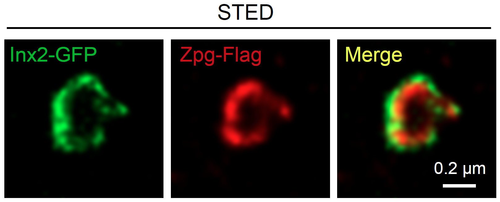 (左) 在幹細胞微環境中表達的「間隙連接蛋白」 (中) 在幹細胞中表達的「間隙連接蛋白」 (右) 幹細胞微環境和幹細胞中的間隙連接蛋白形成的通道