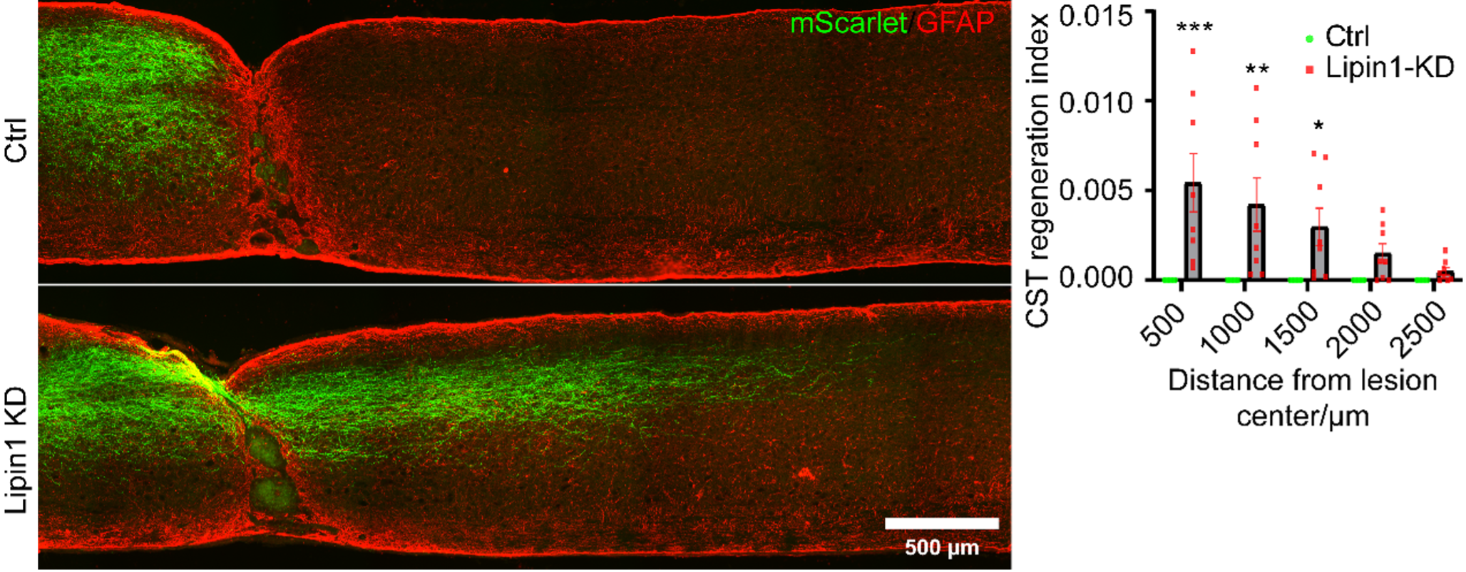 Figure 2 Lipin1 KD facilitates robust CST axon regeneration after complete spinal cord injury.