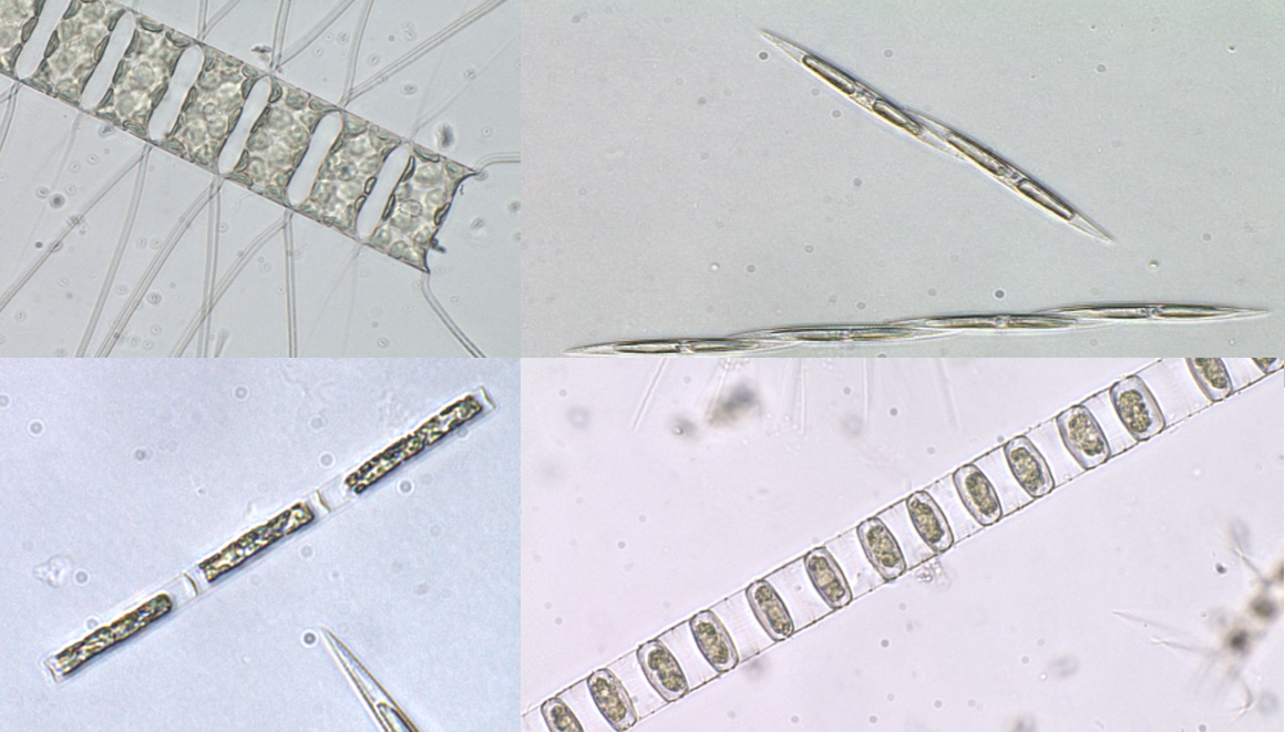 显微镜下的硅藻
