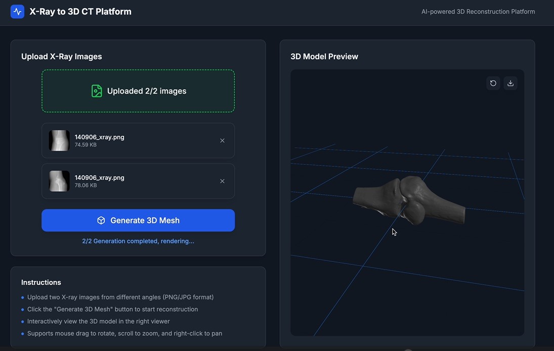 AI platform