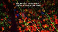 New Discovery Gives Hope for Central Nervous System Repair