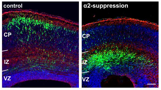 图 示 正 常 大 脑 神 经 细 胞 迁 移 （ 左 ） 及 α2-chimaerin 抑 制 导 致 大 脑 神 经 细 胞 迁 移 异 常 （ 右 ） ， 荧 光 绿 色 部 分 为 神 经 细 胞 。	