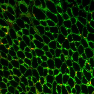A cross section of skeletal muscle tissue with muscle fibers shown in green and the muscle stem cells shown in red.