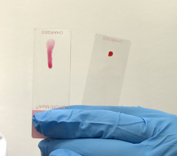  The new hydrogel changes from solid (right) to liquid state upon light exposure