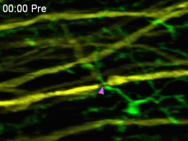 免疫细胞迅速从稍远位置转移至受损位置，并包围朗飞结（以紫色标示）以防止轴突进一步退化